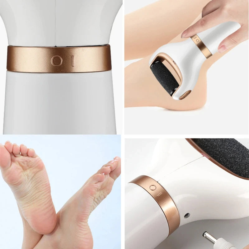 SmoothSole™ USB Foot Callus Remover