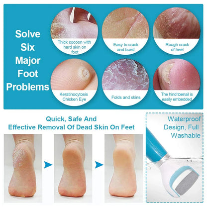 SmoothSole™ USB Foot Callus Remover